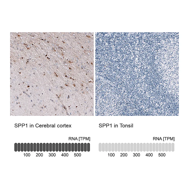 Atlas Antibodies Anti-SPP1 Antibody