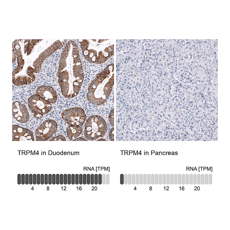 Atlas Antibodies Anti-TRPM4 Antibody