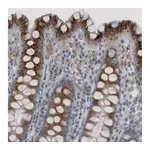 Atlas Antibodies Anti-ACAA1 Antibody