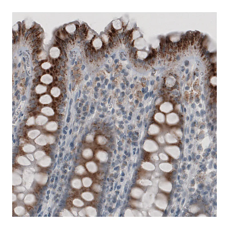 Atlas Antibodies Anti-ACAA1 Antibody