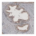 Atlas Antibodies Anti-ACAA1 Antibody