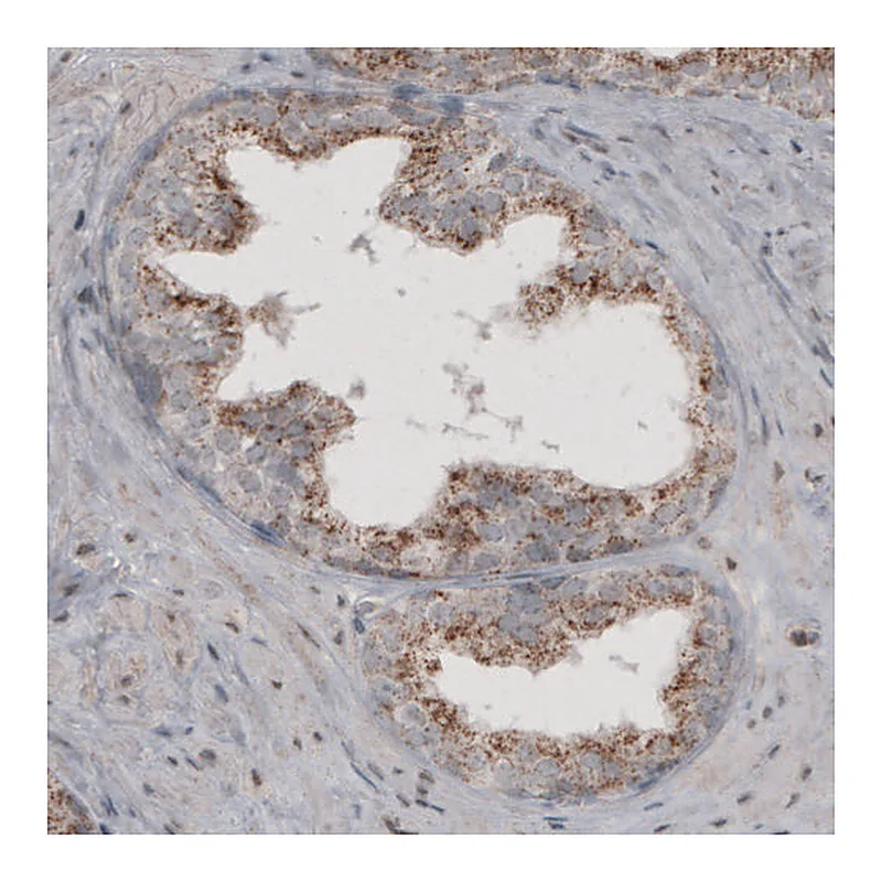 Atlas Antibodies Anti-ACAA1 Antibody