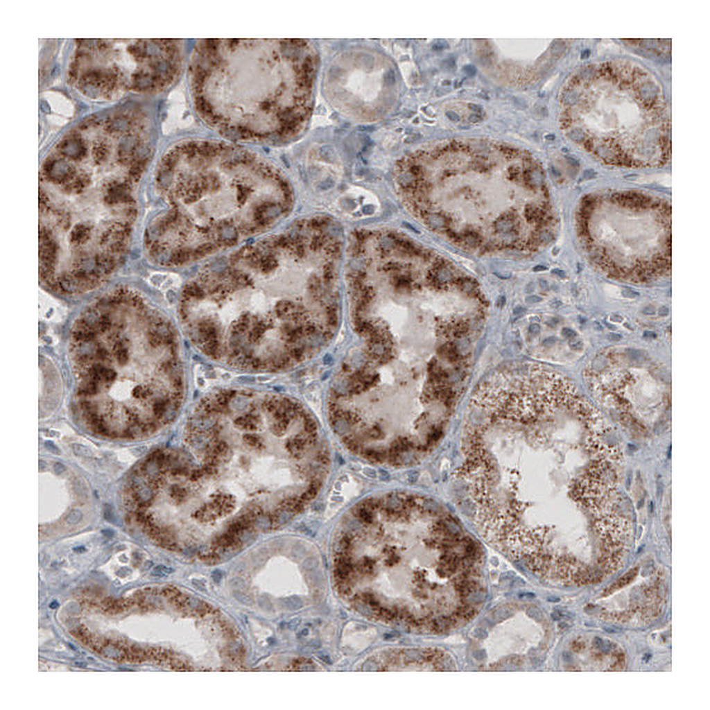 Atlas Antibodies Anti-ACAA1 Antibody