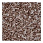 Atlas Antibodies Anti-ACAA1 Antibody