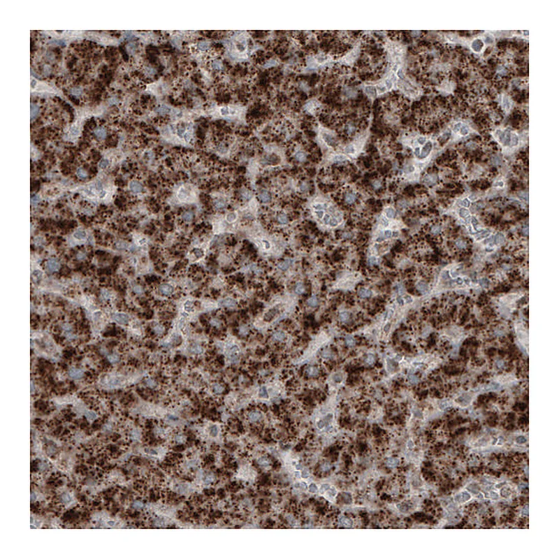 Atlas Antibodies Anti-ACAA1 Antibody