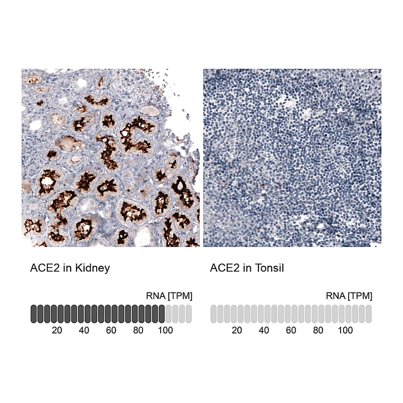 Atlas Antibodies Anti-ACE2 Antibody