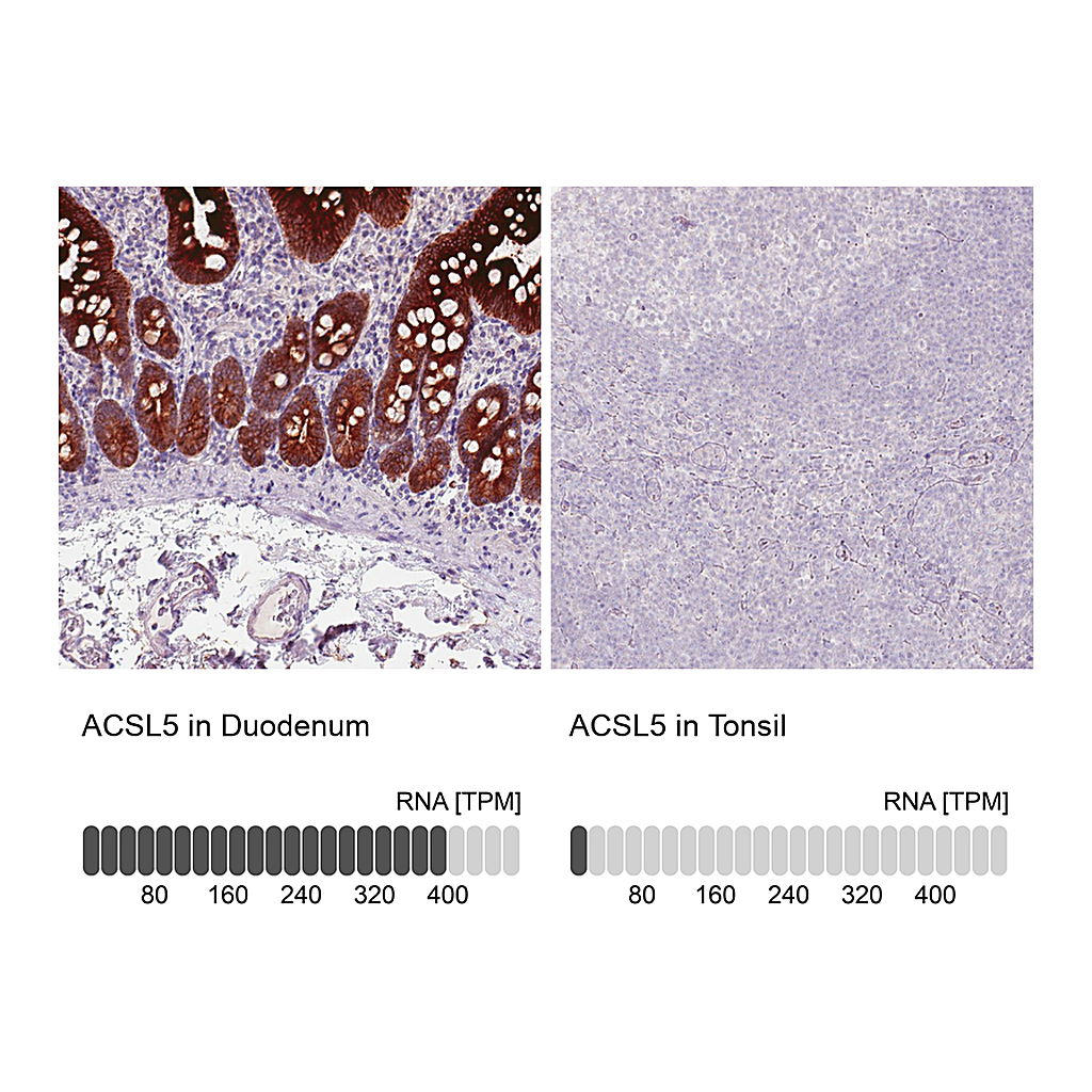 Atlas Antibodies Anti-ACSL5 Antibody