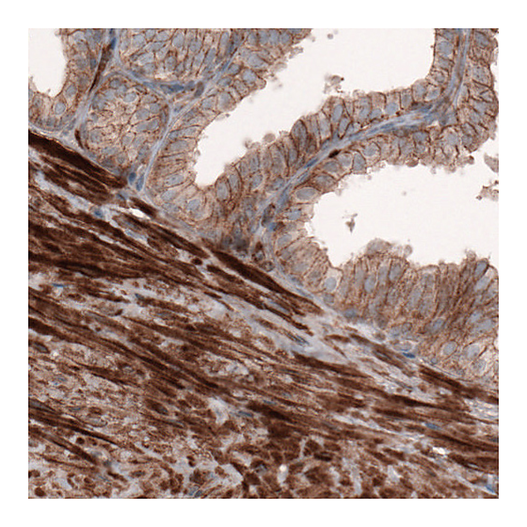Atlas Antibodies Anti-ACTB Antibody