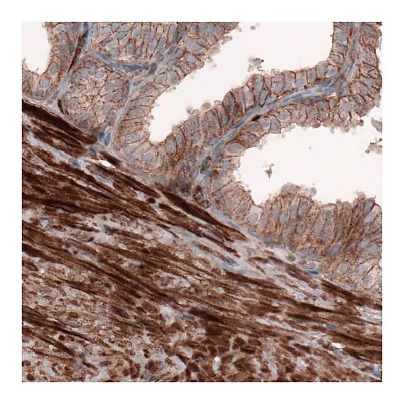 Atlas Antibodies Anti-ACTB Antibody