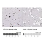 Atlas Antibodies Anti-ADAR Antibody