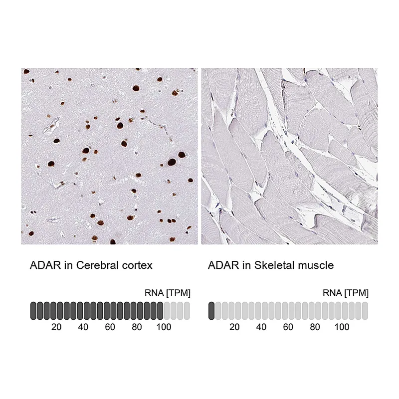 Atlas Antibodies Anti-ADAR Antibody