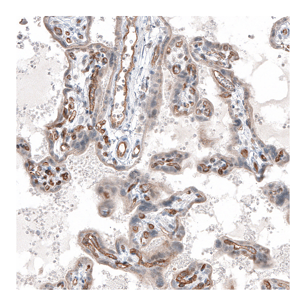 Atlas Antibodies Anti-ADGRL4 Antibody