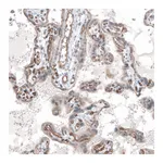 Atlas Antibodies Anti-ADGRL4 Antibody