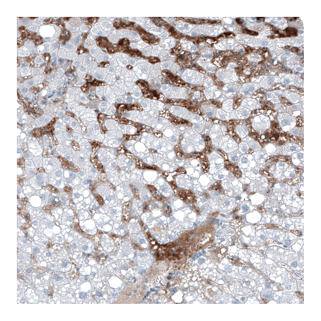 Atlas Antibodies Anti-AFP Antibody