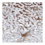 Atlas Antibodies Anti-AFP Antibody
