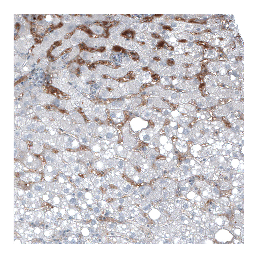 Atlas Antibodies Anti-AFP Antibody