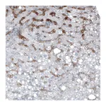 Atlas Antibodies Anti-AFP Antibody