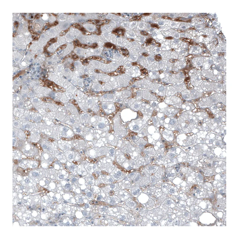 Atlas Antibodies Anti-AFP Antibody