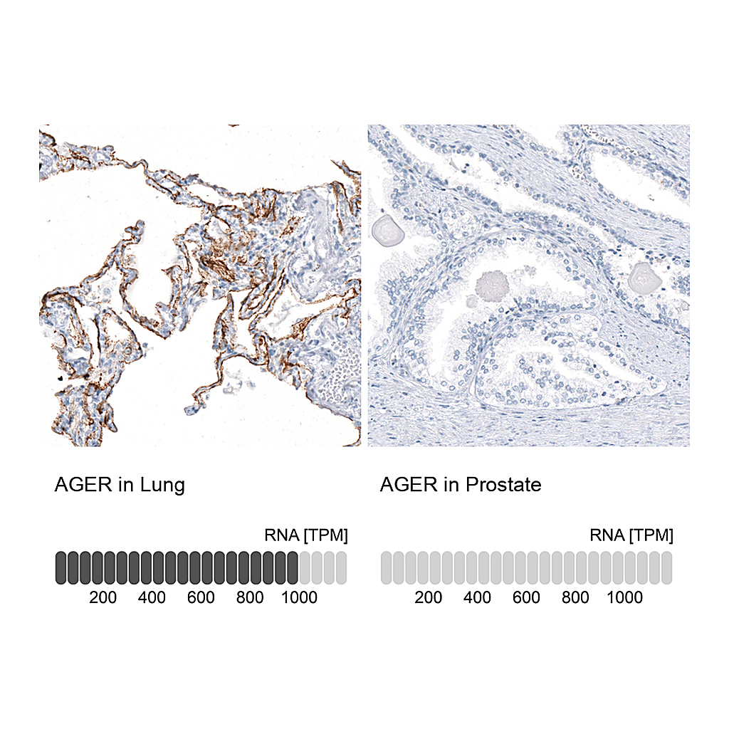Atlas Antibodies Anti-AGER Antibody