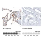 Atlas Antibodies Anti-AGER Antibody