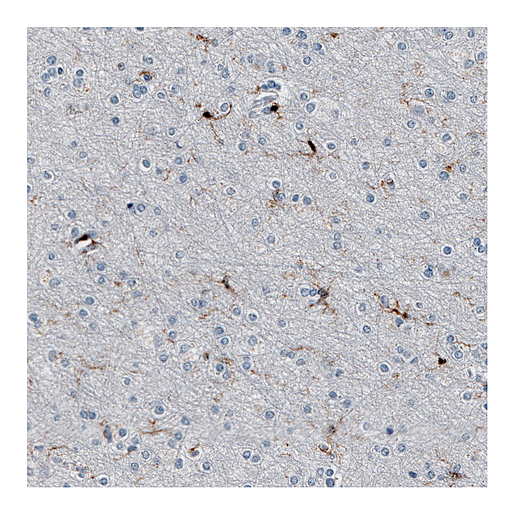 Atlas Antibodies Anti-AIF1 Antibody