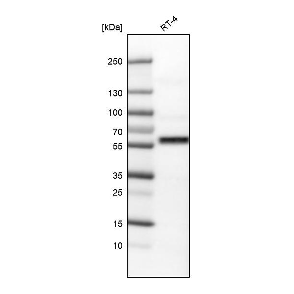 Atlas Antibodies Anti-AKT1 Antibody