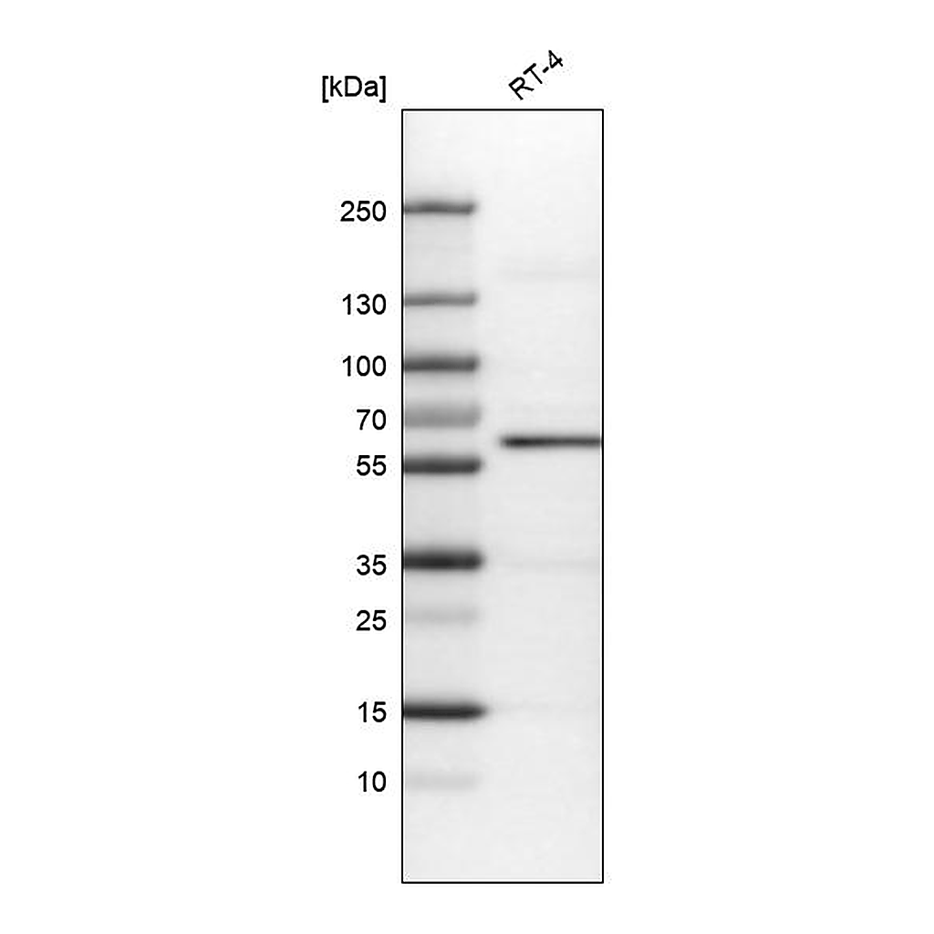 Atlas Antibodies Anti-AKT1 Antibody
