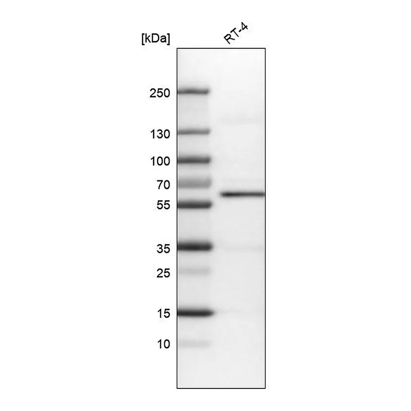 Atlas Antibodies Anti-AKT1 Antibody