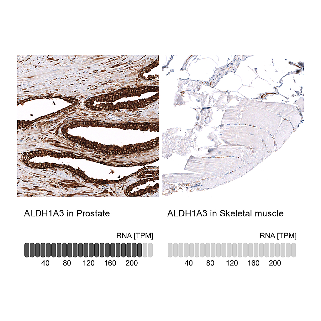 Atlas Antibodies Anti-ALDH1A3 Antibody
