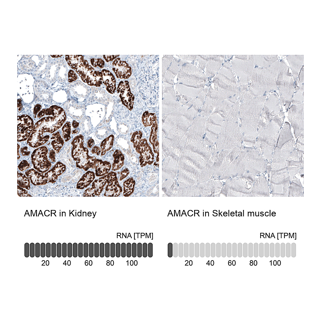 Atlas Antibodies Anti-AMACR Antibody