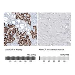 Atlas Antibodies Anti-AMACR Antibody