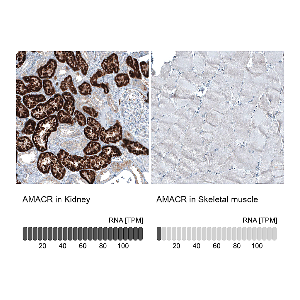 Atlas Antibodies Anti-AMACR Antibody