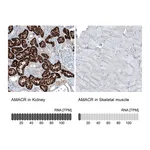 Atlas Antibodies Anti-AMACR Antibody