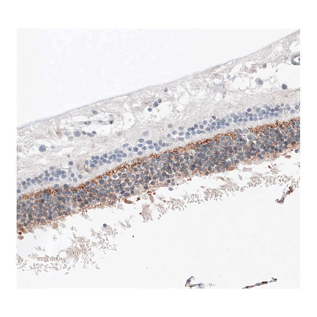 Atlas Antibodies Anti-ANO2 Antibody