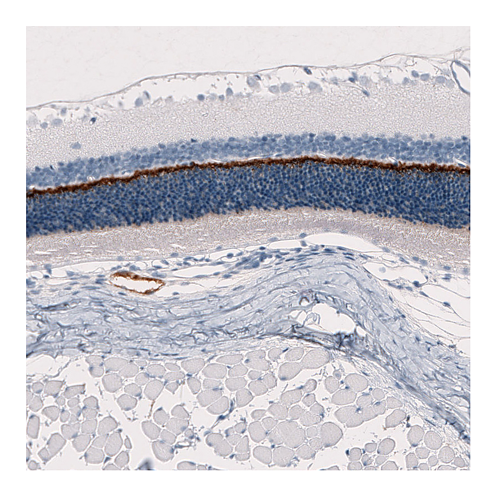 Atlas Antibodies Anti-ANO2 Antibody
