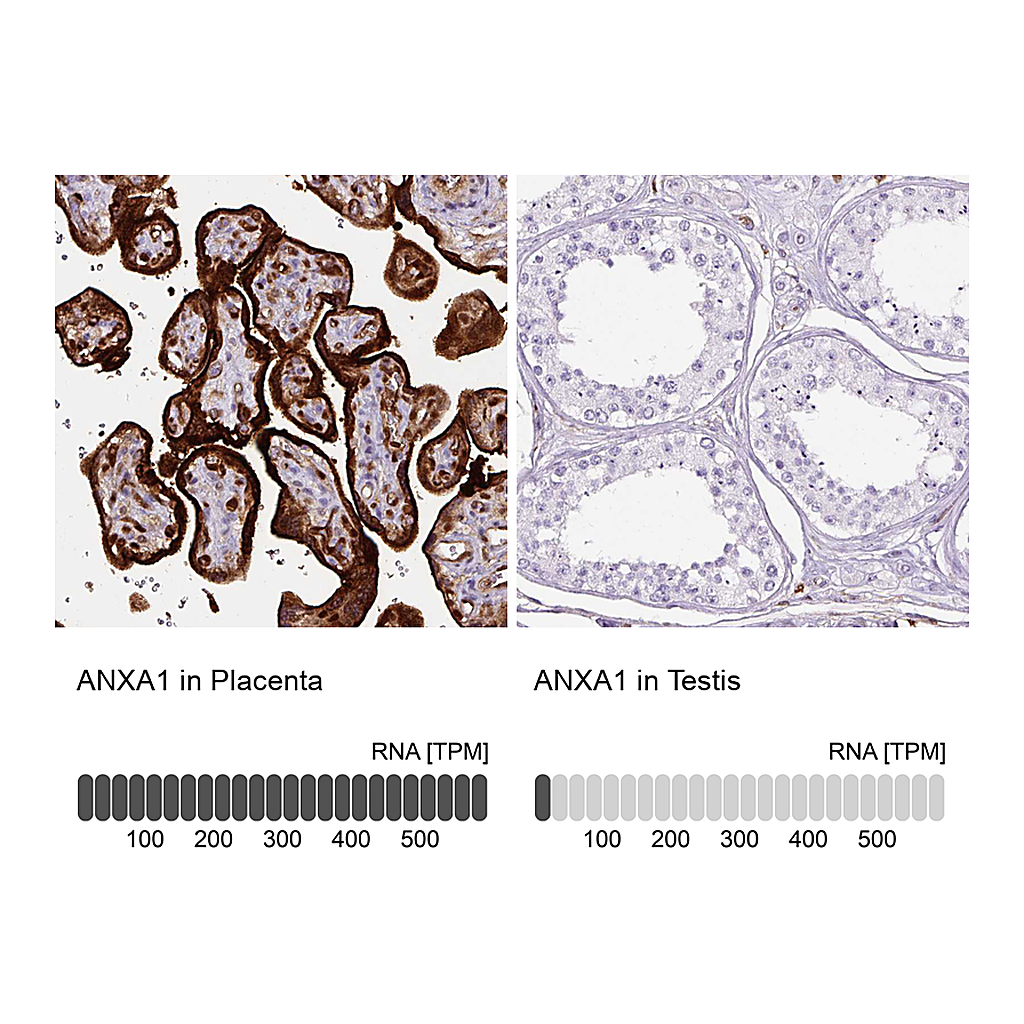 Atlas Antibodies Anti-ANXA1 Antibody