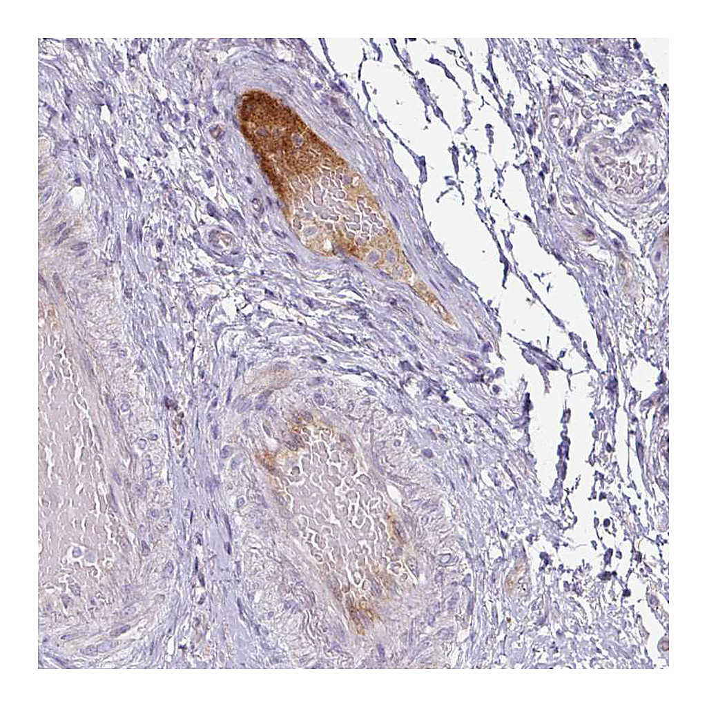 Atlas Antibodies Anti-APOL1 Antibody