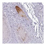 Atlas Antibodies Anti-APOL1 Antibody