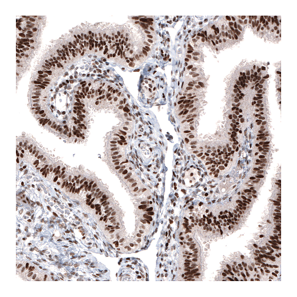 Atlas Antibodies Anti-ARID1A Antibody