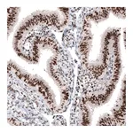 Atlas Antibodies Anti-ARID1A Antibody