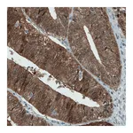 Atlas Antibodies Anti-ASRGL1 Antibody