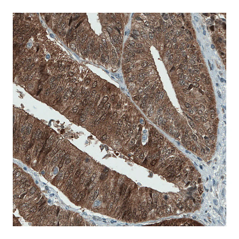 Atlas Antibodies Anti-ASRGL1 Antibody