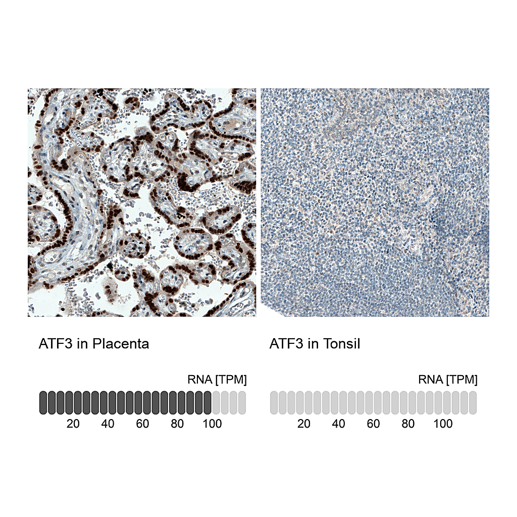 Atlas Antibodies Anti-ATF3 Antibody