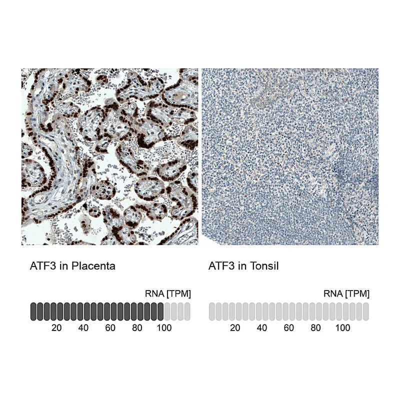 Atlas Antibodies Anti-ATF3 Antibody