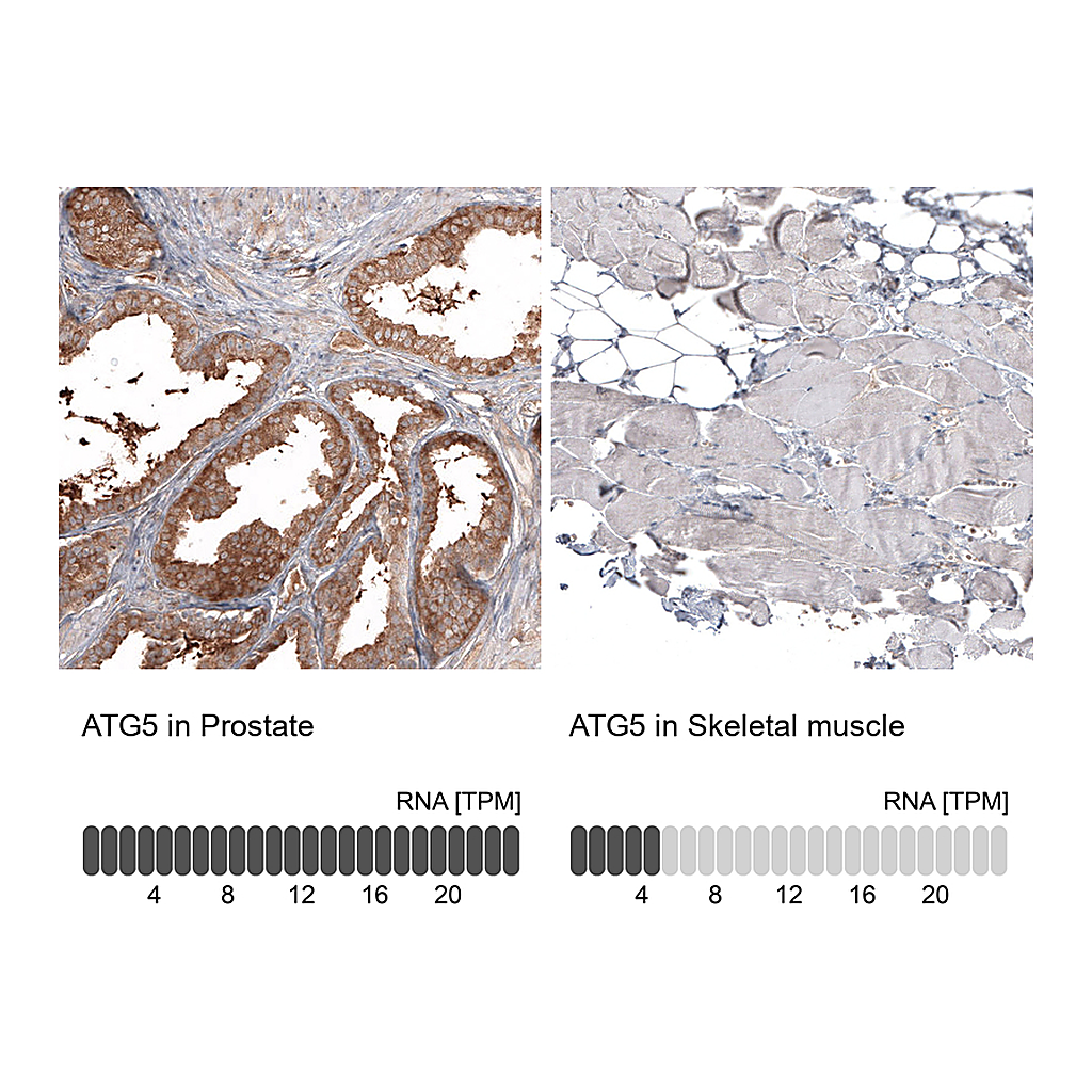 Atlas Antibodies Anti-ATG5 Antibody