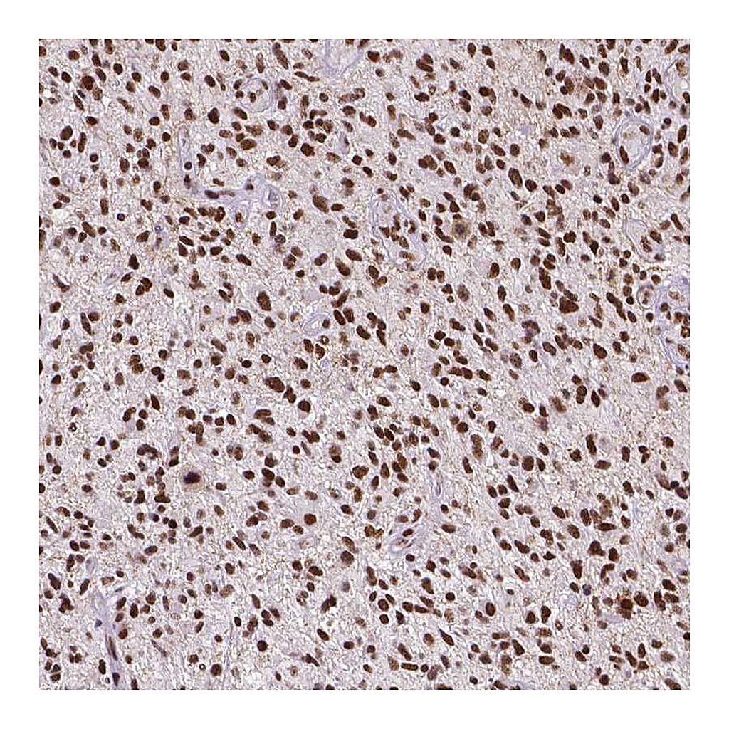 Atlas Antibodies Anti-ATRX Antibody