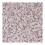Atlas Antibodies Anti-ATRX Antibody