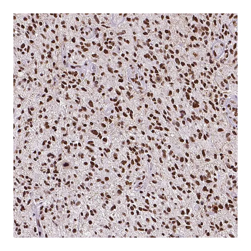 Atlas Antibodies Anti-ATRX Antibody