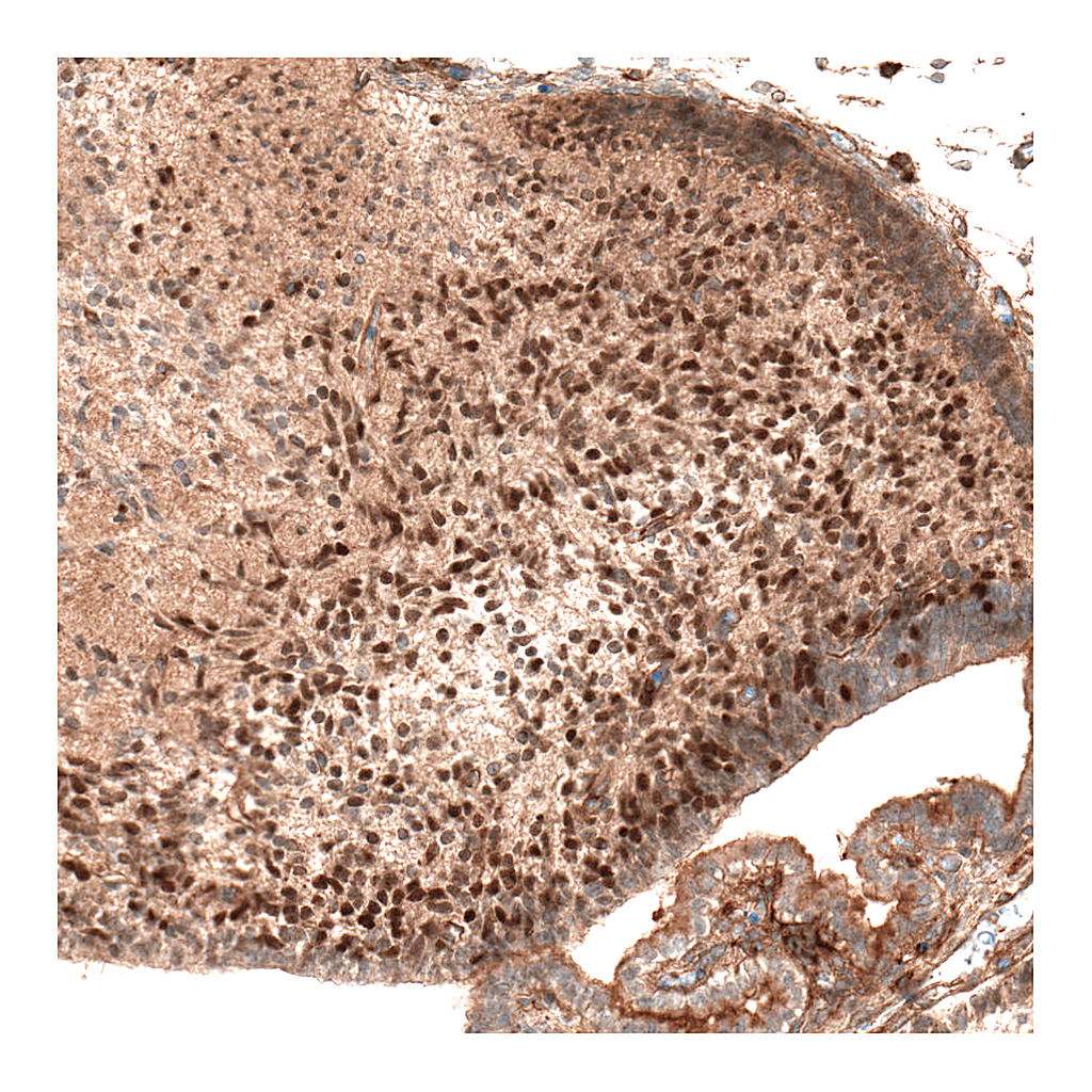 Atlas Antibodies Anti-AUTS2 Antibody