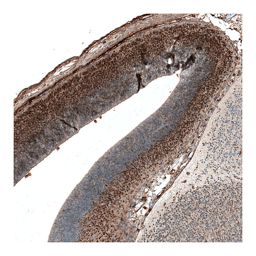 Atlas Antibodies Anti-AUTS2 Antibody